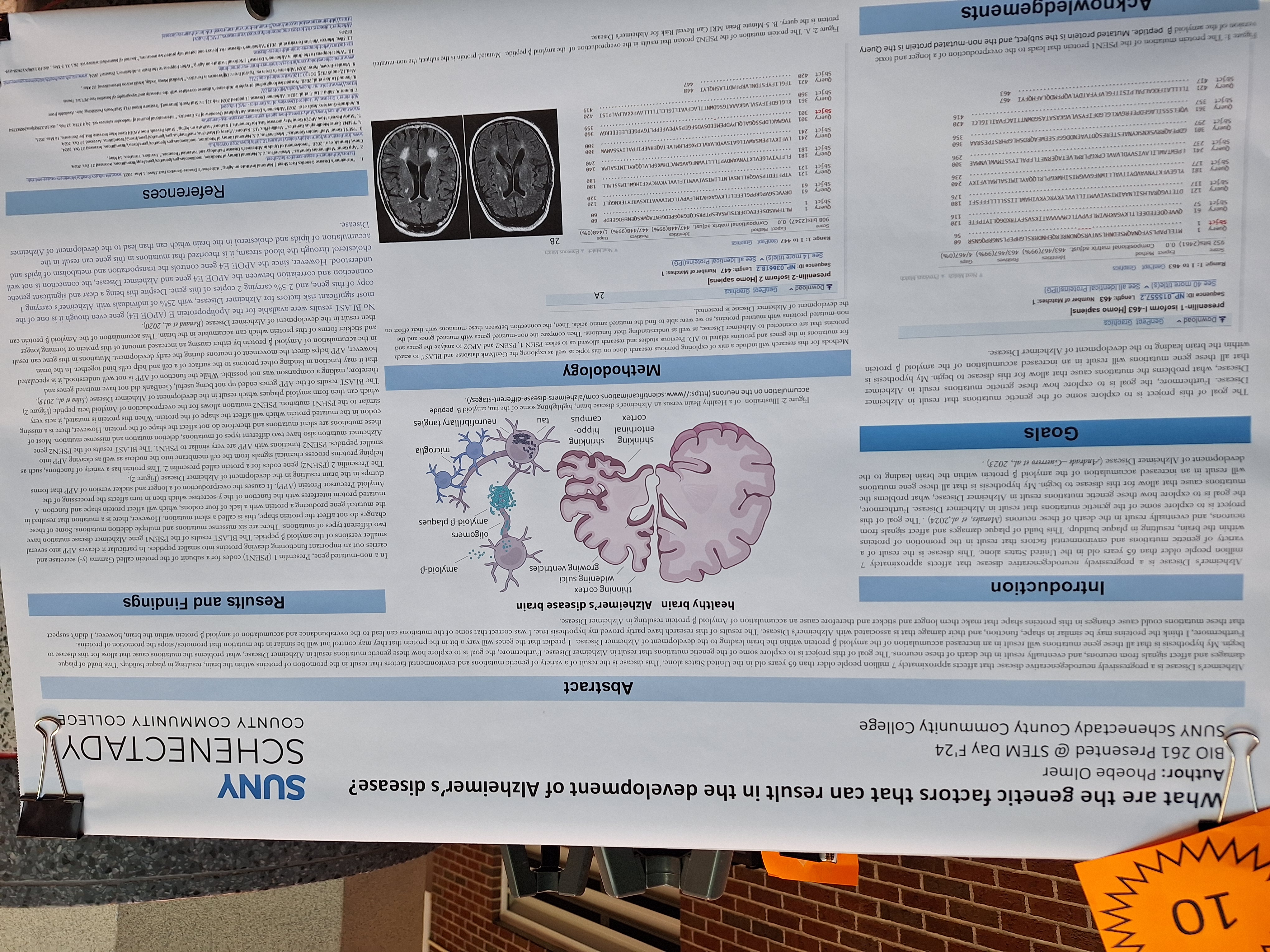 Research poster about Alzheimer's on easel